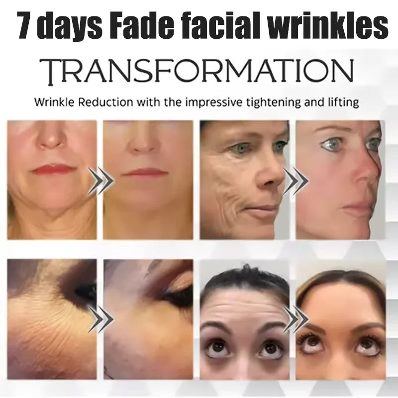 5 Stück Kollagen-Protein-Pflaster, Lifting, Straffung, Verblassen feiner Linien, hydrokristallines Pflaster, Anti-Aging, tiefe feuchtigkeitsspendende Maske, Korea-Produkte